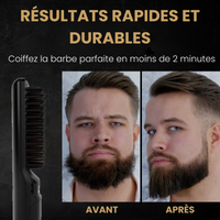 Beardium Pro – lisseur à barbe sans fil noir
